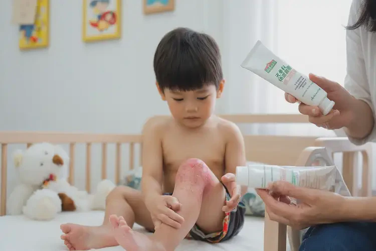 少兒小腿容易長濕疹不管它會自己痊愈嗎(圖2)