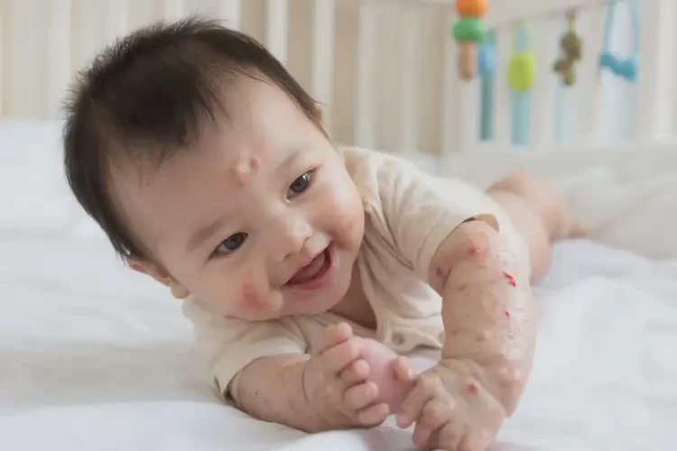 嬰兒脖子上偶爾起濕疹能徹底自愈嗎(圖2)