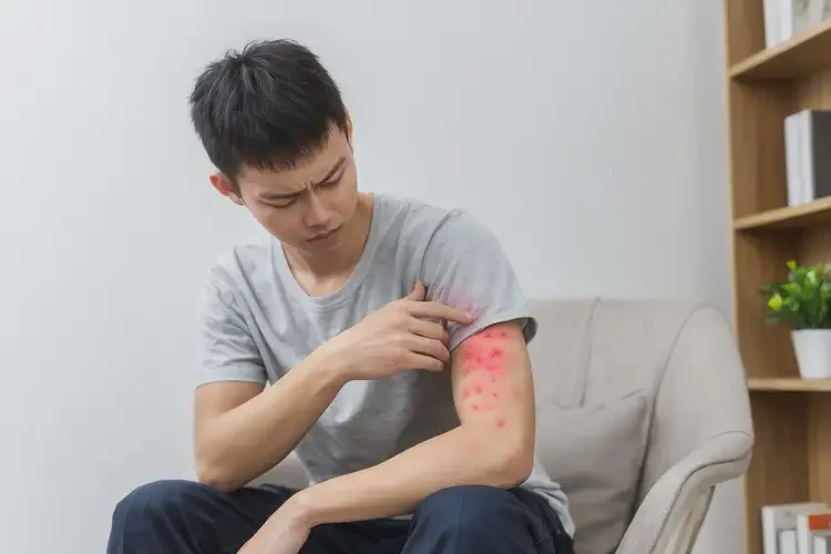 青年人屁股上經(jīng)常長濕疹能徹底自愈嗎(圖1)