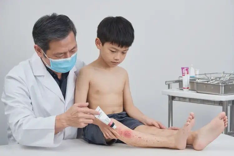 少兒小腿容易長濕疹不管它會自己痊愈嗎(圖3)