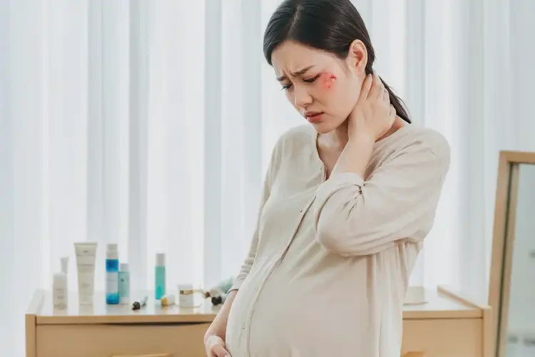 孕妇脖子经常起湿疹能彻底自愈吗(图4)