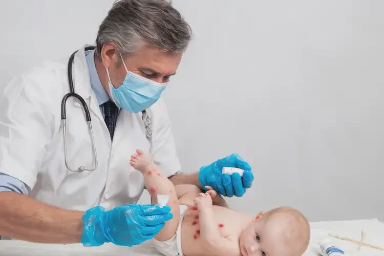 幼兒四肢經(jīng)常起濕疹能夠徹底治愈嗎(圖3)