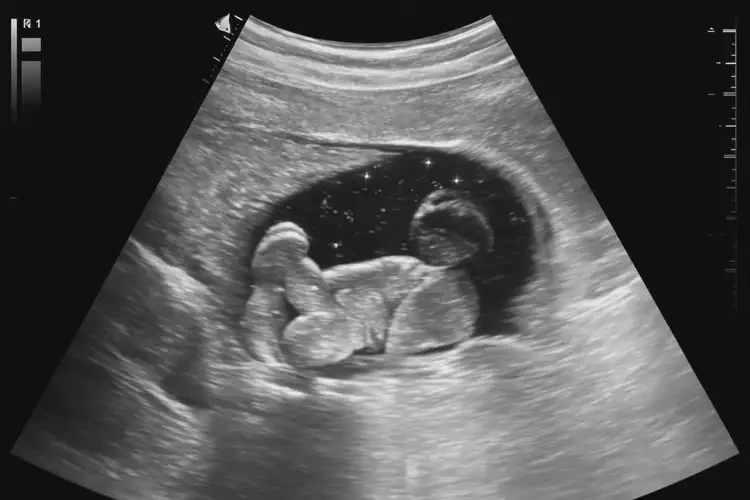 懷孕第10周胎心90寶寶還能要嗎(圖4)