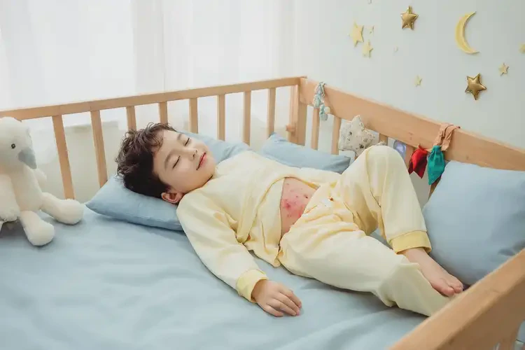 小孩肚子上經(jīng)常起濕疹不管它會(huì)自己好嗎(圖2)