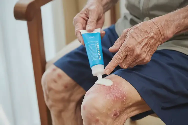 老人大腿上長濕疹不管它會自己自愈嗎(圖2)