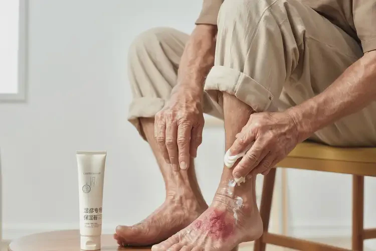 老年人腳上有濕疹不管它會(huì)自己痊愈嗎(圖3)