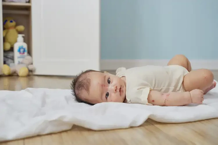 嬰兒脖子上偶爾長濕疹可以徹底自愈嗎(圖4)