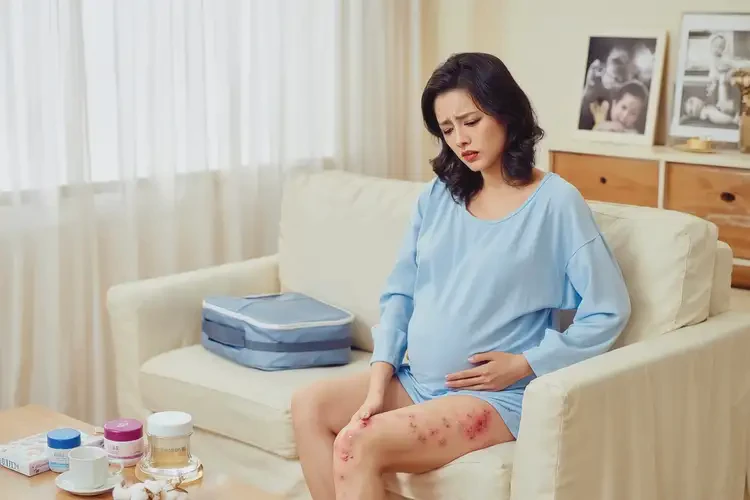 孕婦大腿出現(xiàn)濕疹能靠自己自愈嗎(圖4)