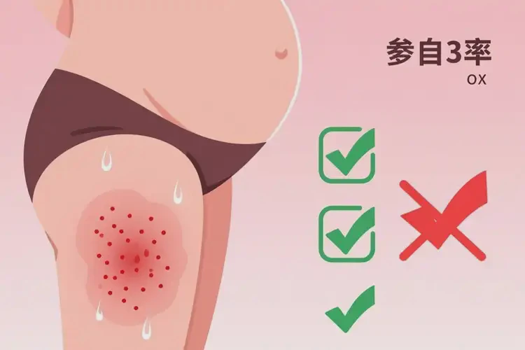 孕婦大腿上經(jīng)常起濕疹不管它會(huì)自己痊愈嗎(圖2)