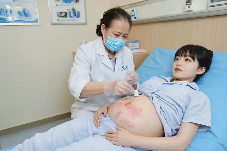 產(chǎn)婦肚子容易起濕疹能夠徹底治愈嗎(圖3)