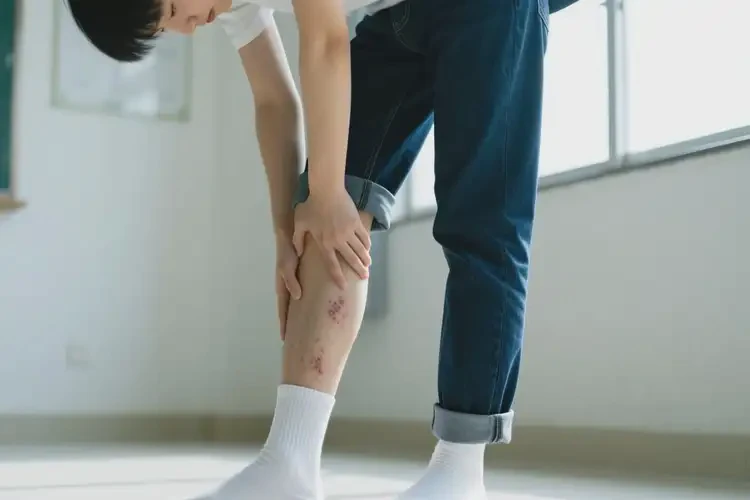 大學(xué)生大腿上有濕疹可以徹底自愈嗎(圖2)
