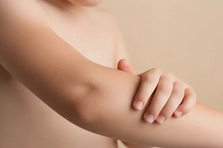 孩子手臂起湿疹可不可以彻底自愈(图1)