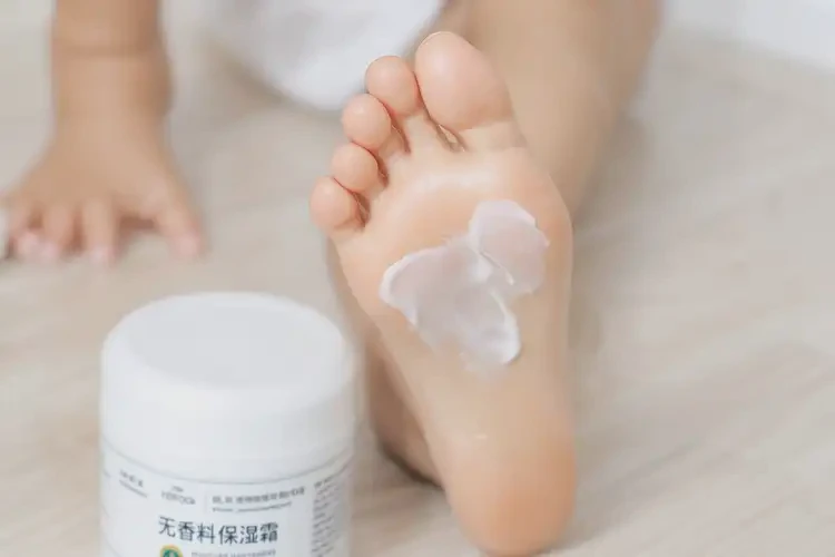 小孩腳上出濕疹能徹底自愈嗎(圖3)