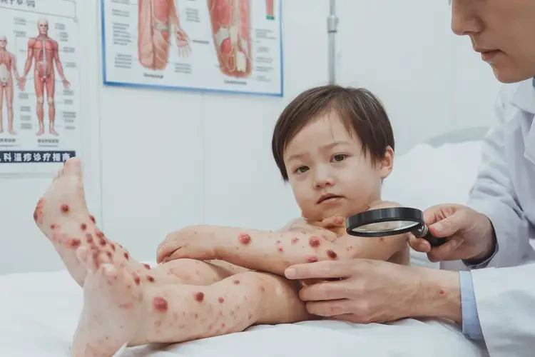 幼兒四肢經(jīng)常長濕疹不管它會(huì)自己好嗎(圖4)