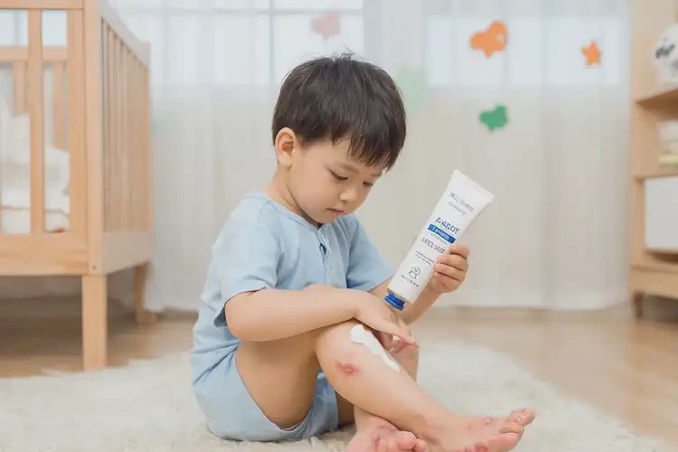 兒童腳上起濕疹不管它會(huì)自己好嗎(圖3)