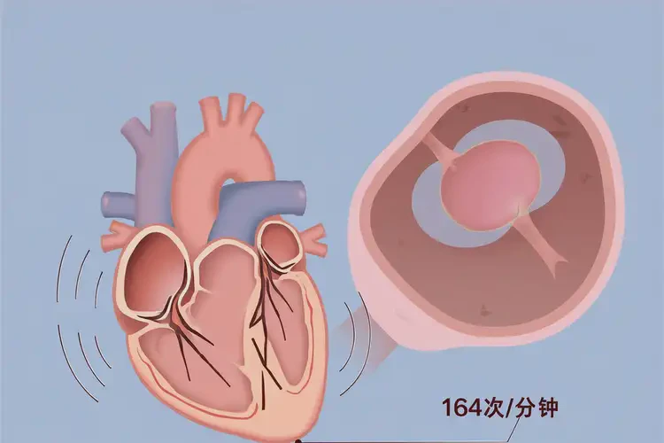 懷孕五個(gè)半月胎心164正常嗎(圖3)