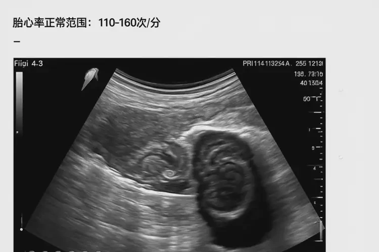 孕13周胎心率85寶寶還能要嗎(圖4)