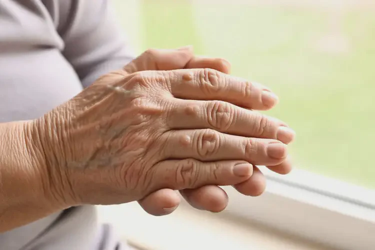 老年人身上起湿疹能不能彻底自愈(图1)