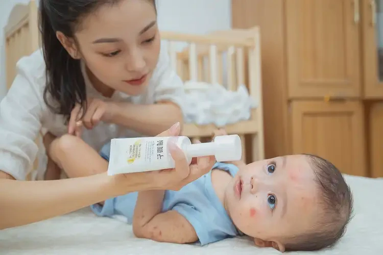 小兒屁股起濕疹能夠徹底治愈嗎(圖4)