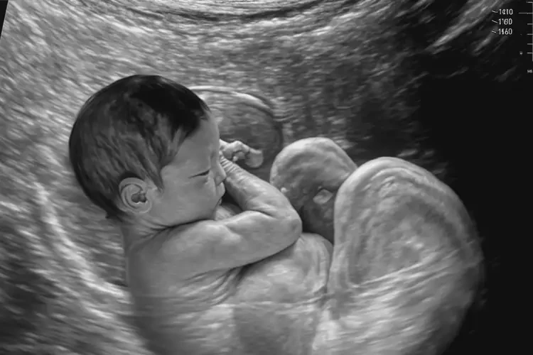 孕23周1天胎心率92有危险吗(图4)