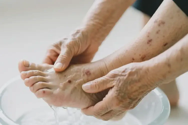 高龄老人脚上偶尔长湿疹能够彻底治愈吗(图4)