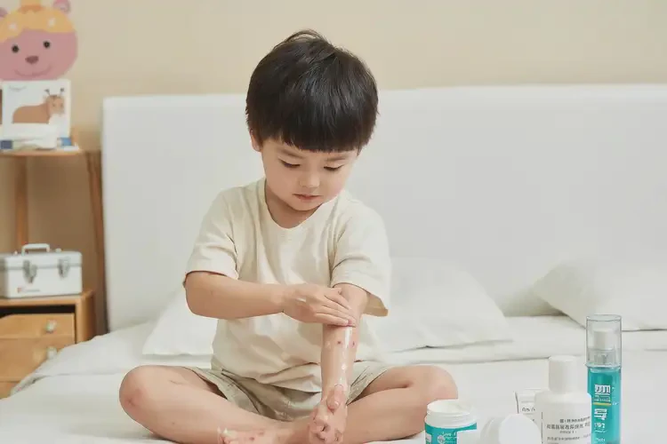 小兒全身有濕疹能徹底自愈嗎(圖2)