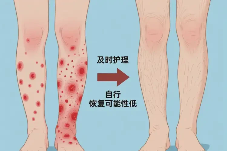 女人小腿上容易長濕疹不管它會自己好嗎(圖2)