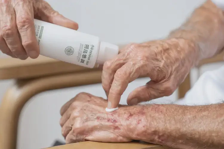 老年人全身出濕疹能徹底自愈嗎(圖3)