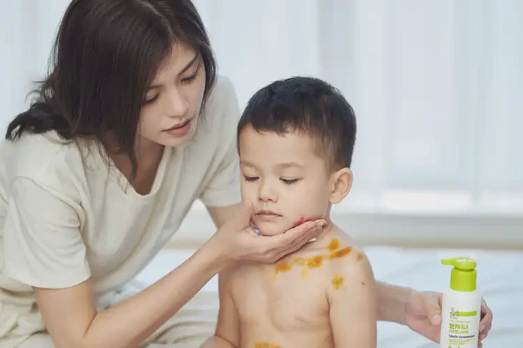 孩子脖子上偶爾起濕疹能靠自己自愈嗎(圖2)