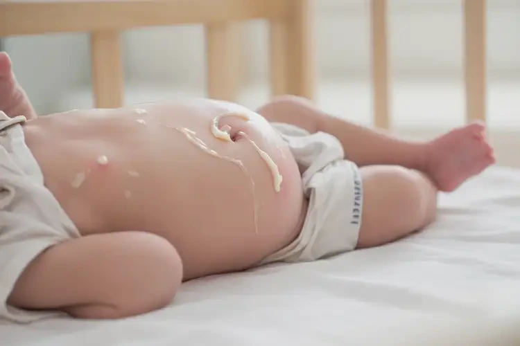 新生兒肚子出現(xiàn)濕疹可不可以徹底自愈(圖2)