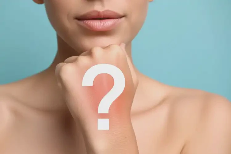 女生手上偶爾起濕疹不管它會自己自愈嗎(圖1)