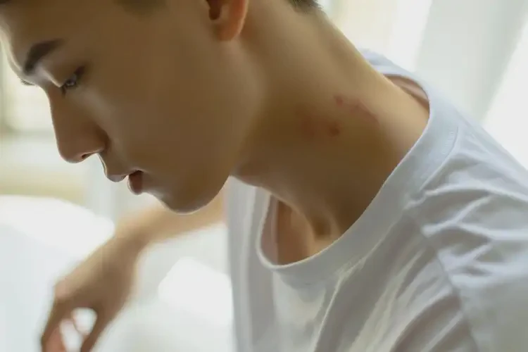 青年人脖子有濕疹不管它會(huì)自己好嗎(圖4)