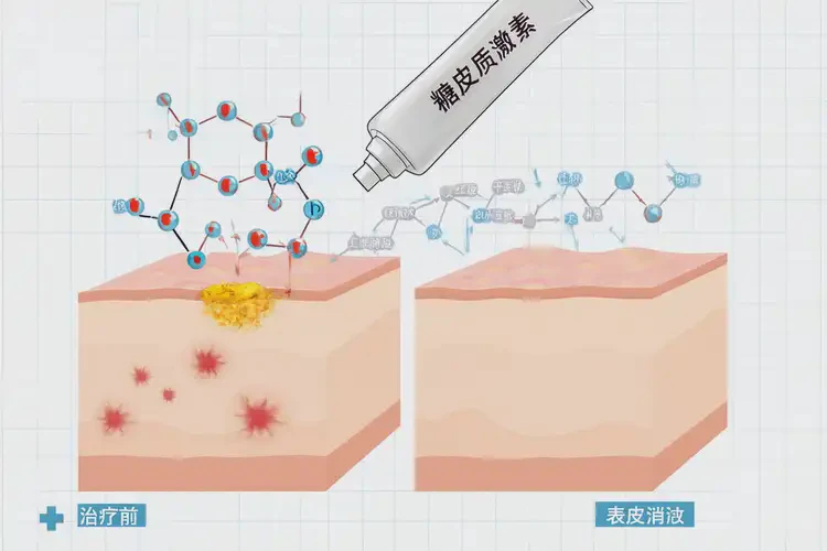 青少年臉上出現(xiàn)濕疹能夠徹底治愈嗎(圖3)