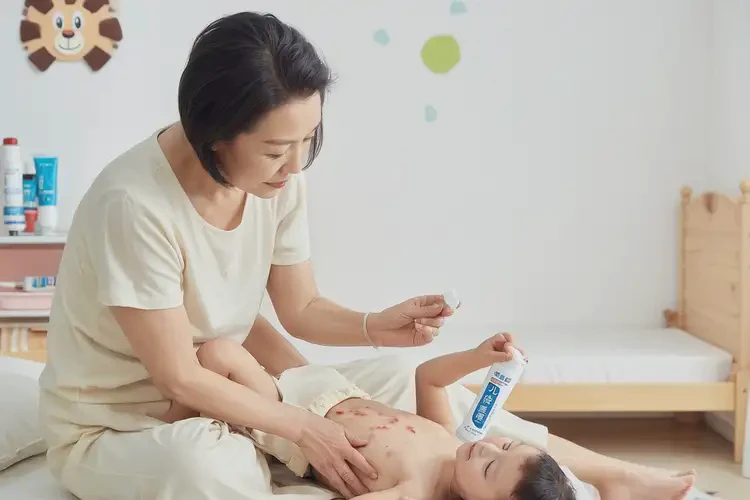 小孩肚子上經(jīng)常起濕疹不管它會(huì)自己好嗎(圖3)