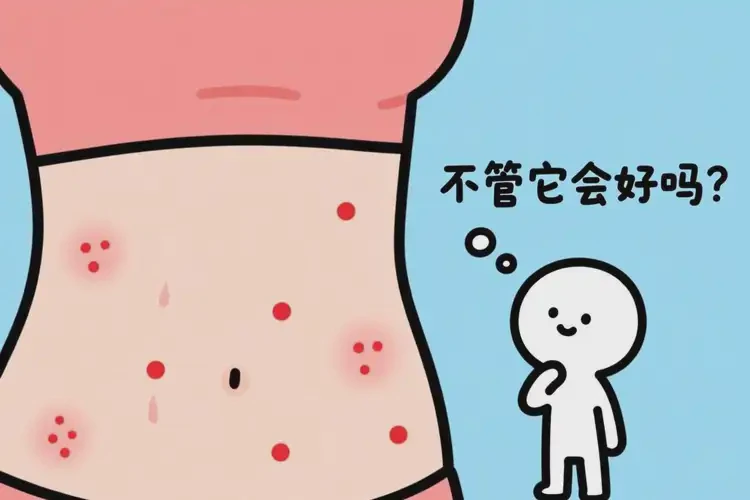 女性肚子偶爾起濕疹不管它會自己好嗎(圖2)