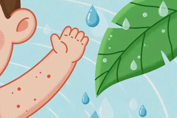 小兒四肢容易起濕疹能徹底自愈嗎(圖4)