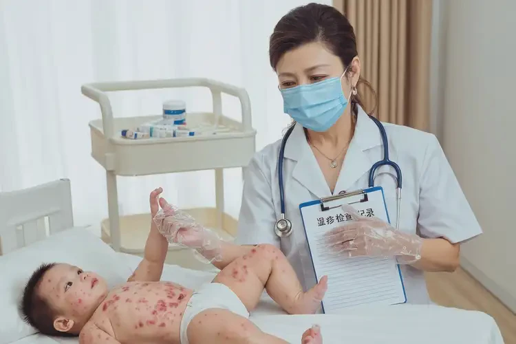 幼兒肚子經(jīng)常起濕疹能不能徹底自愈(圖2)