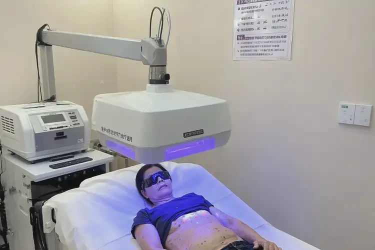 中學生身上容易起濕疹能不能徹底自愈(圖1)