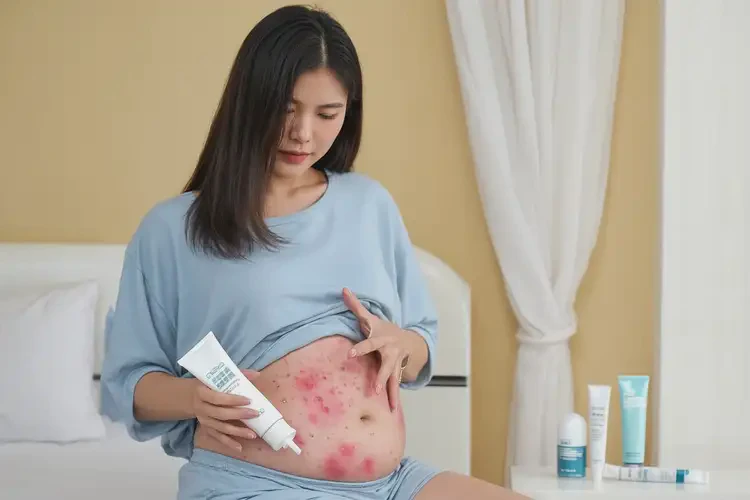 女人肚子上偶爾長(zhǎng)濕疹能夠徹底治愈嗎(圖2)