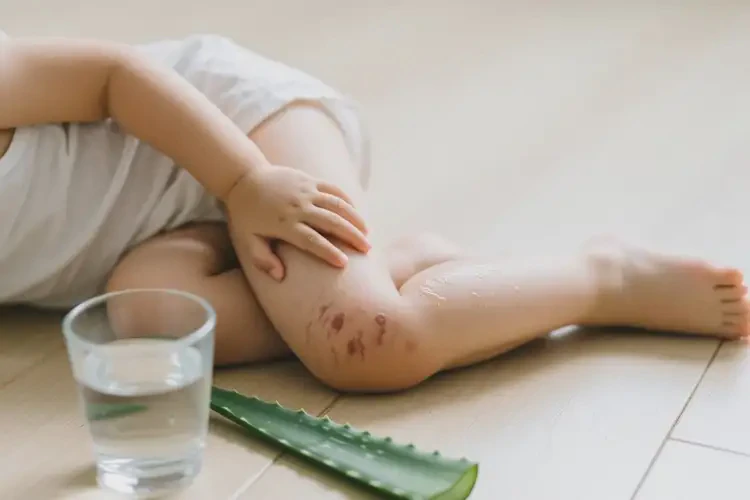 兒童大腿上經(jīng)常長濕疹可以徹底自愈嗎(圖1)