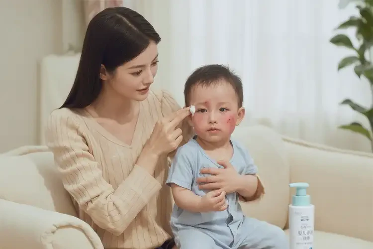 新生兒臉上偶爾起濕疹可不可以徹底自愈(圖3)