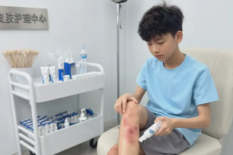 青少年小腿上長濕疹可以徹底自愈嗎(圖2)