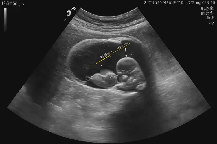 懷孕20多天胎心90左右正常嗎(圖4)