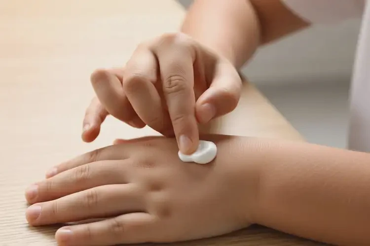 小兒手上容易長濕疹不管它會自己自愈嗎(圖3)