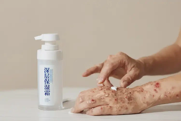 男生手上容易長濕疹不管它會自己自愈嗎(圖3)