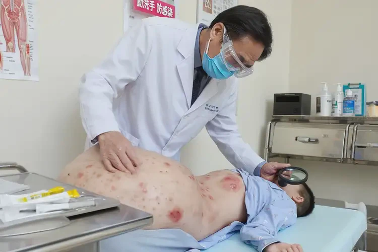 孩子肚子上偶尔起湿疹不管它会自己好吗(图2)