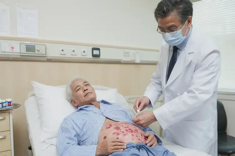 老年人肚子有濕疹能不能徹底自愈(圖3)