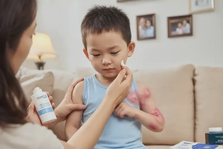 小兒身上出濕疹不管它會(huì)自己好嗎(圖3)