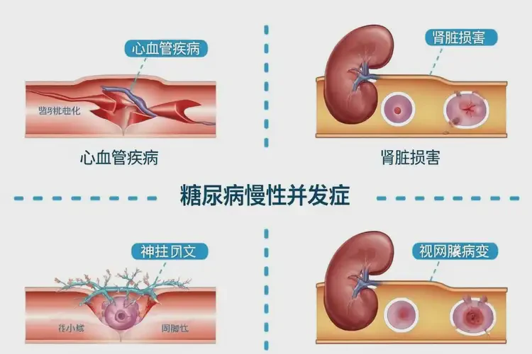 男性空腹血糖20(圖1)