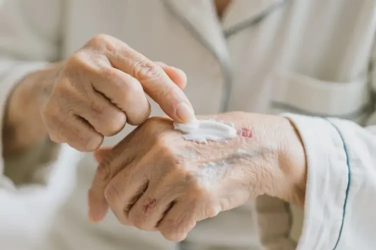 高龄老人手上经常长湿疹不管它会自己好吗(图1)